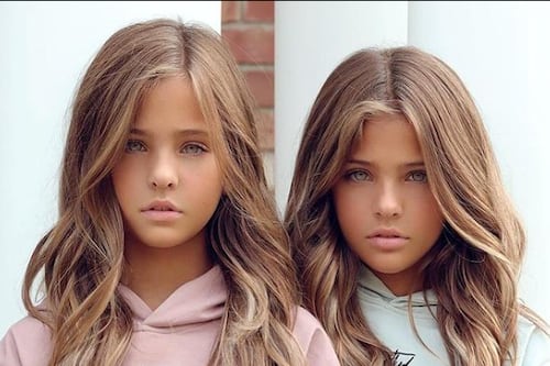 ¿Te acuerdas de las gemelas ‘más bellas del mundo’? Ya tienen 12 años y parecen modelos 