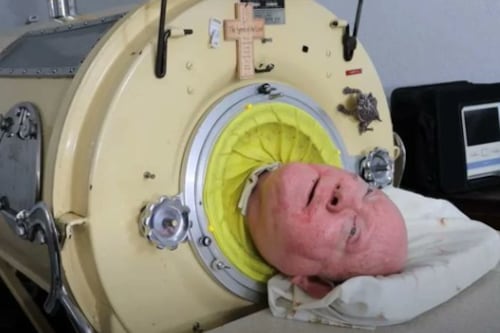 Murió el último hombre que vivía en un “pulmón de hierro”: pasó 70 años acostado dentro de la máquina